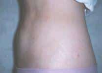 After Image