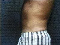 After Image