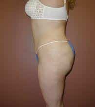 After Image