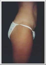 After Image