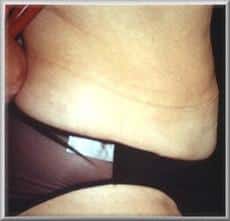 After Image