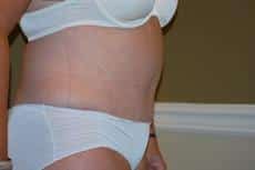 After Image
