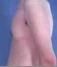 After Image