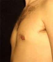 After Image