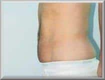 After Image