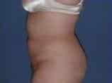After Image