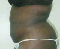 After Image