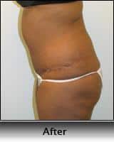 After Image