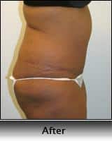After Image