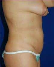 After Image