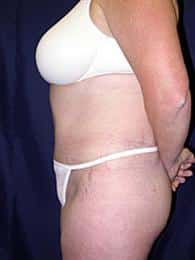 After Image