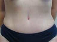 After Image