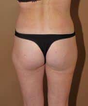 After Image