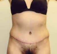 After Image