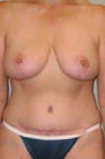 After Image