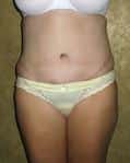After Image