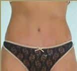 After Image