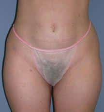 After Image
