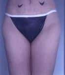 After Image