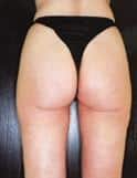 After Image