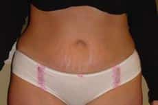 After Image