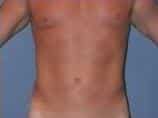 After Image