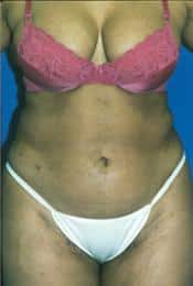 After Image