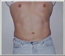 After Image