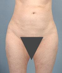 After Image