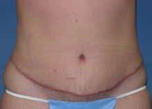 After Image