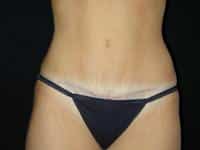 After Image