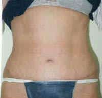 After Image