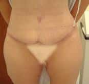 After Image
