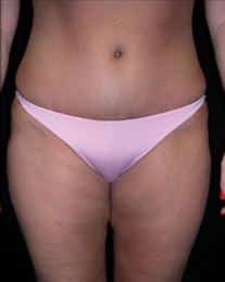 After Image