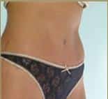 After Image