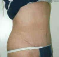 After Image