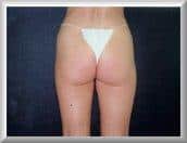 After Image