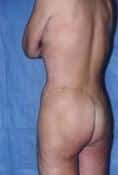 After Image