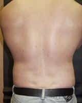 After Image