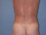 After Image