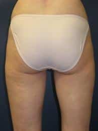 After Image