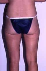 After Image