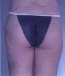After Image