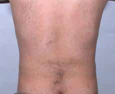 After Image