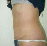 After Image