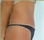 After Image