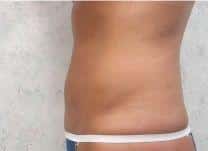 After Image
