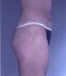 After Image