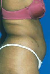 After Image