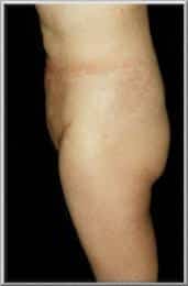 After Image